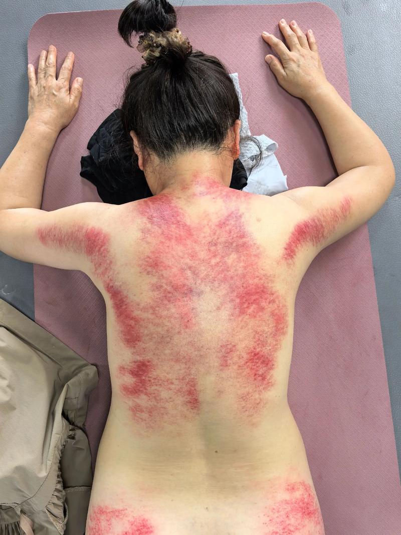 中医推拿:在日常中找寻健康